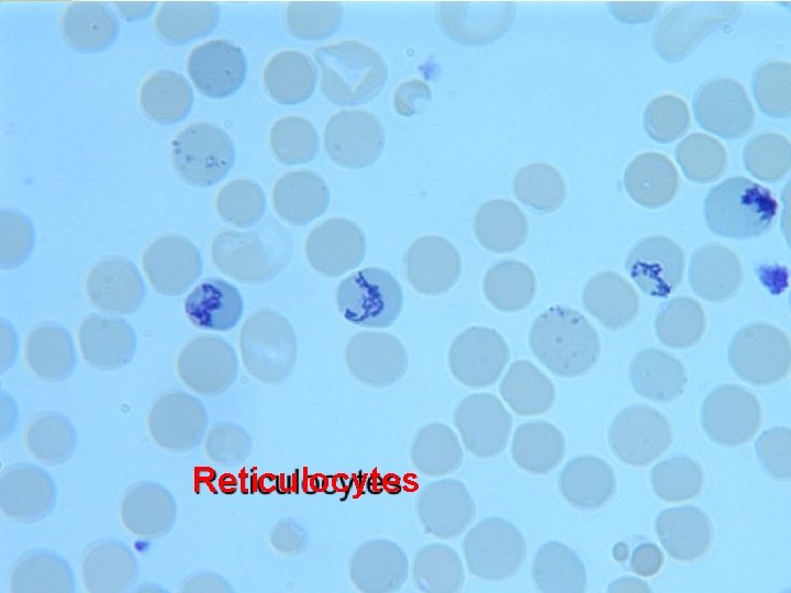 Reticulocytes 