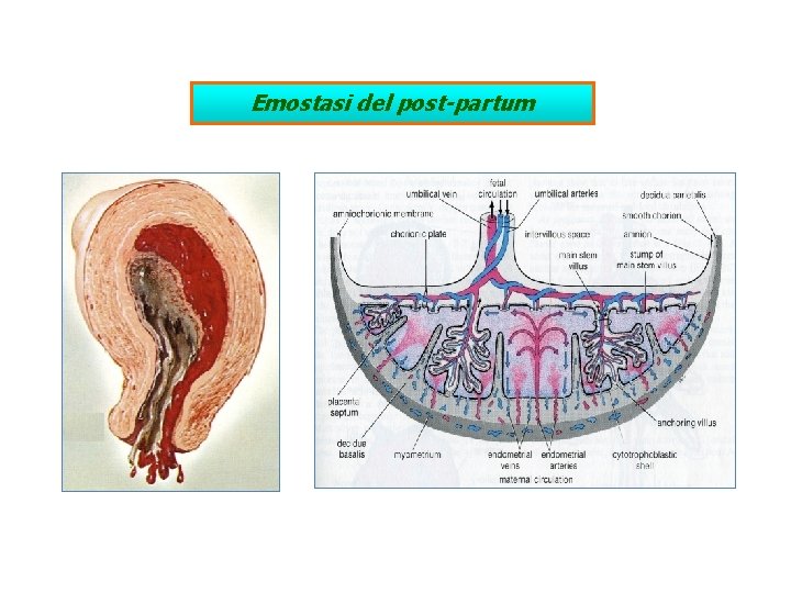 Emostasi del post-partum 