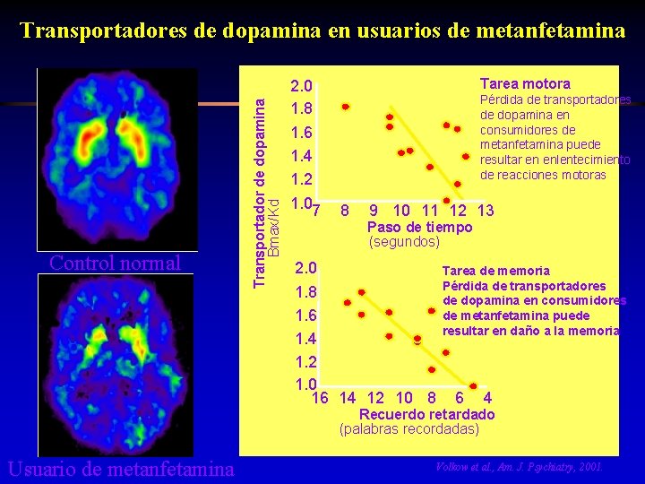 Control normal Transportador de dopamina Bmax/Kd Transportadores de dopamina en usuarios de metanfetamina 2.
