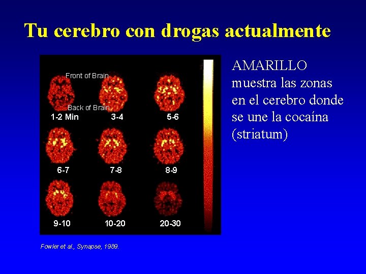 Tu cerebro con drogas actualmente Front of Brain Back of Brain 1 -2 Min