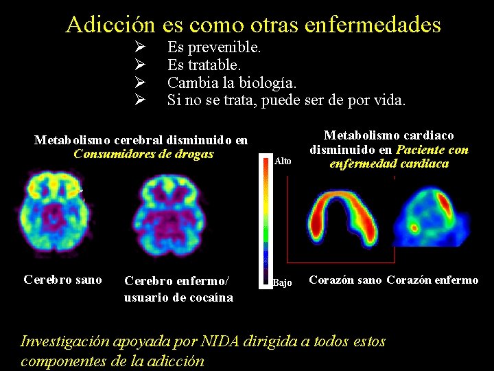 Adicción es como otras enfermedades Ø Ø Es prevenible. Es tratable. Cambia la biología.