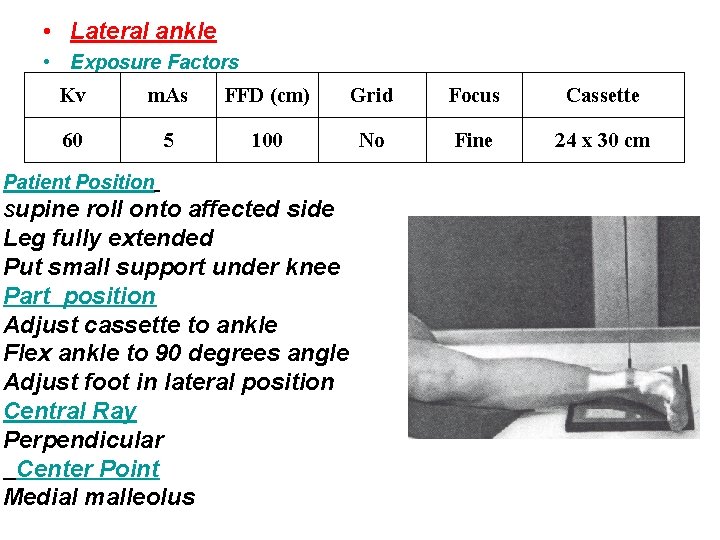 • Lateral ankle • Exposure Factors Kv m. As FFD (cm) Grid Focus