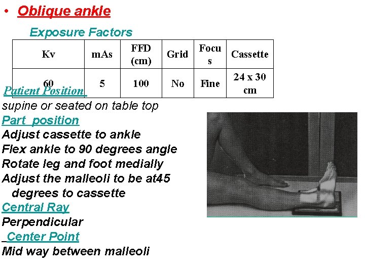  • Oblique ankle Exposure Factors Kv 60 m. As 5 FFD (cm) 100