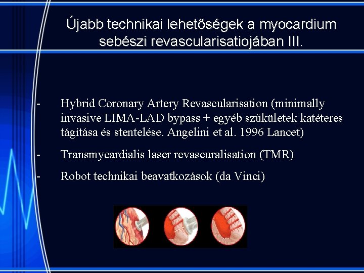 Újabb technikai lehetőségek a myocardium sebészi revascularisatiojában III. - Hybrid Coronary Artery Revascularisation (minimally