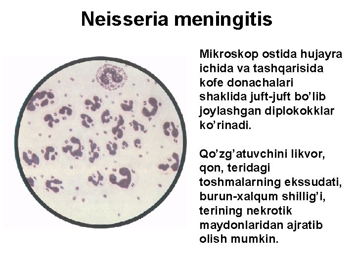 Neisseria meningitis Mikroskop ostida hujayra ichida va tashqarisida kofe donachalari shaklida juft-juft bo’lib joylashgan