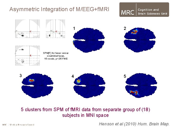 Asymmetric Integration of M/EEG+f. MRI 1 2 4 5 SPM{F} for faces versus scrambled