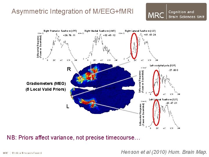 Asymmetric Integration of M/EEG+f. MRI R Gradiometers (MEG) (5 Local Valid Priors) L Right