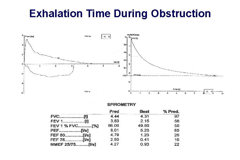 Exhalation Time During Obstruction 