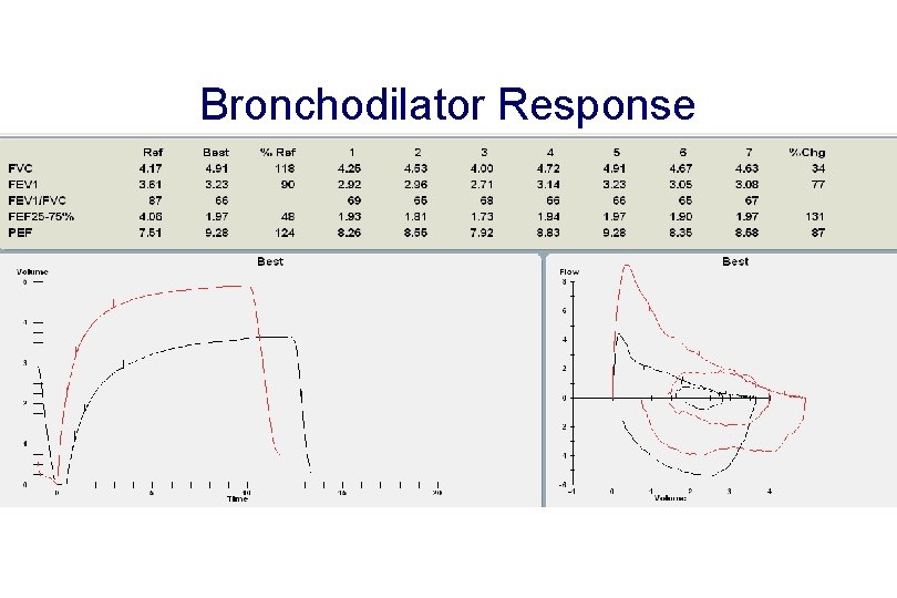 Bronchodilator Response 