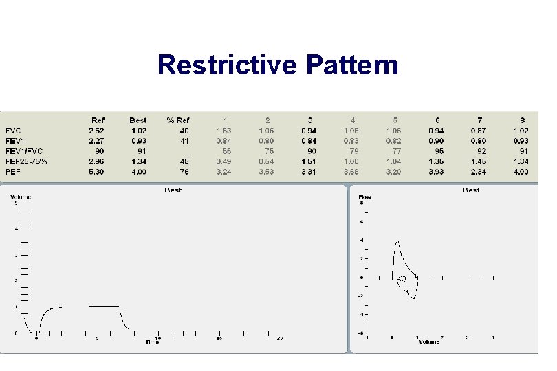 Restrictive Pattern 