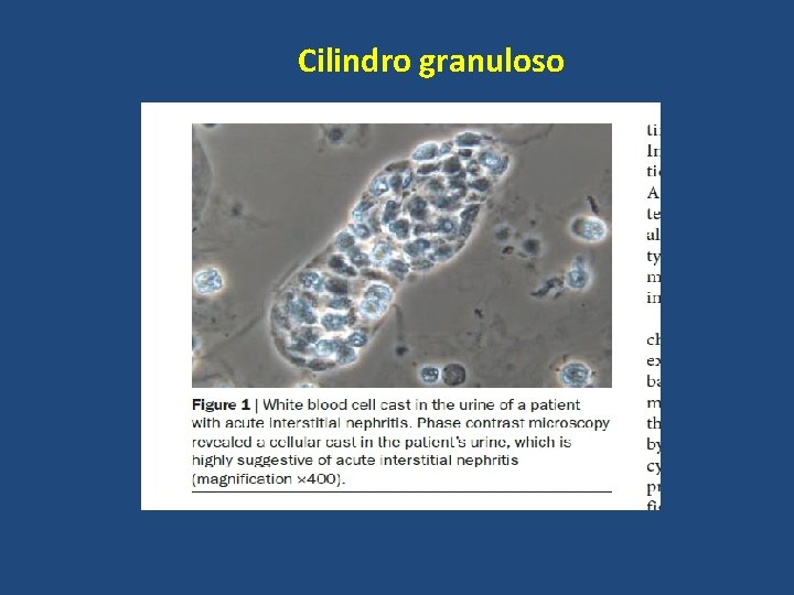 Cilindro granuloso 