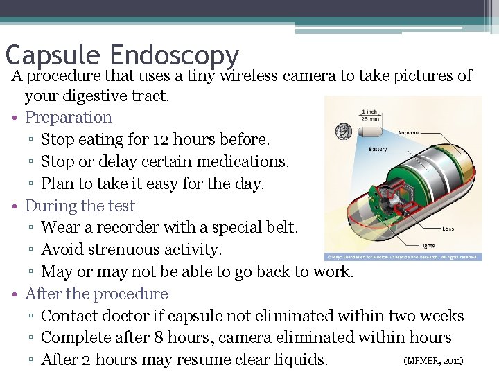 Capsule Endoscopy A procedure that uses a tiny wireless camera to take pictures of