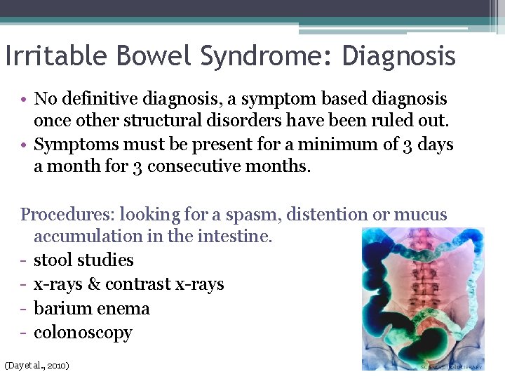 Irritable Bowel Syndrome: Diagnosis • No definitive diagnosis, a symptom based diagnosis once other