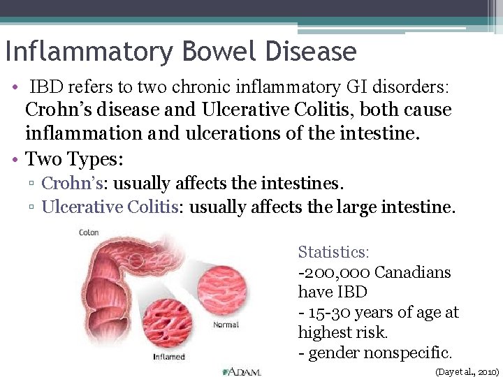 Inflammatory Bowel Disease • IBD refers to two chronic inflammatory GI disorders: Crohn’s disease