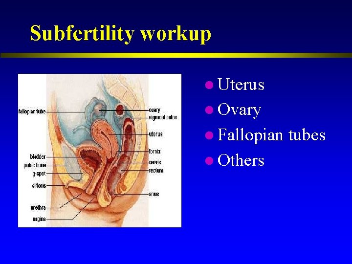 Subfertility workup l Uterus l Ovary l Fallopian l Others tubes 