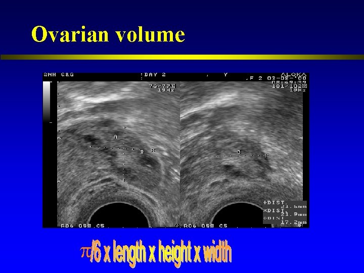 Ovarian volume 