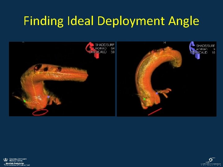Finding Ideal Deployment Angle 