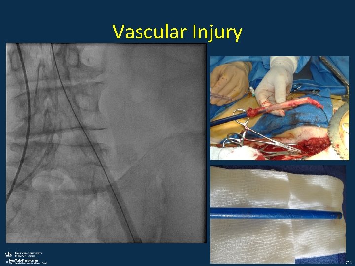 Vascular Injury 