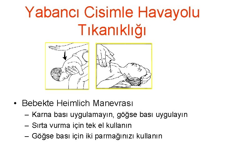 Yabancı Cisimle Havayolu Tıkanıklığı • Bebekte Heimlich Manevrası – Karna bası uygulamayın, göğse bası