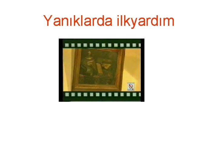 Yanıklarda ilkyardım 