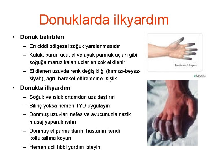 Donuklarda ilkyardım • Donuk belirtileri – En ciddi bölgesel soğuk yaralanmasıdır – Kulak, burun