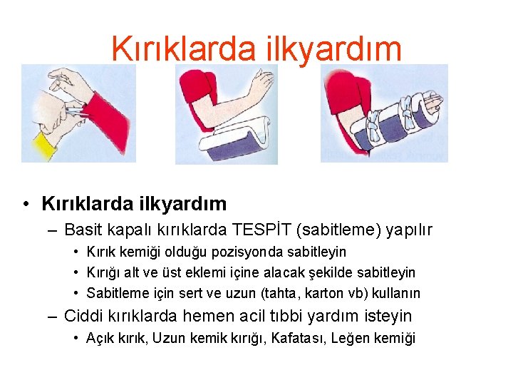 Kırıklarda ilkyardım • Kırıklarda ilkyardım – Basit kapalı kırıklarda TESPİT (sabitleme) yapılır • Kırık