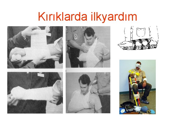 Kırıklarda ilkyardım 