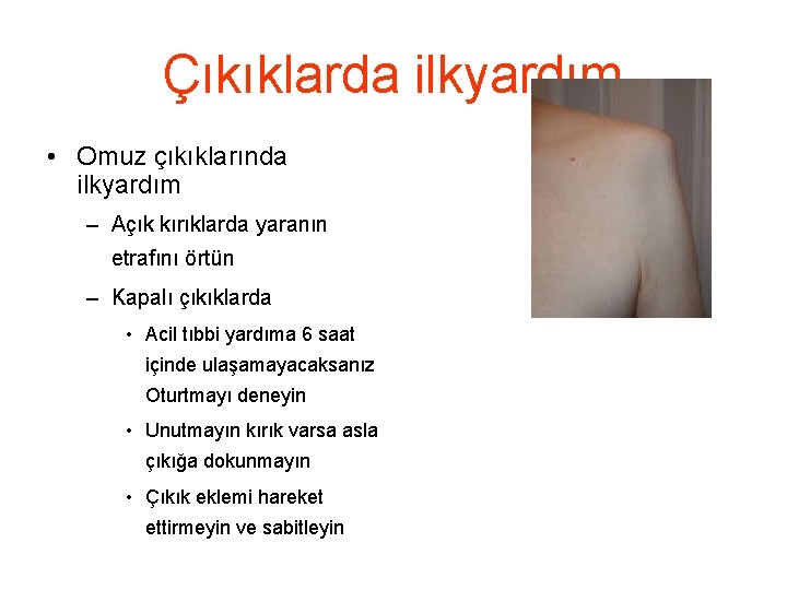 Çıkıklarda ilkyardım • Omuz çıkıklarında ilkyardım – Açık kırıklarda yaranın etrafını örtün – Kapalı