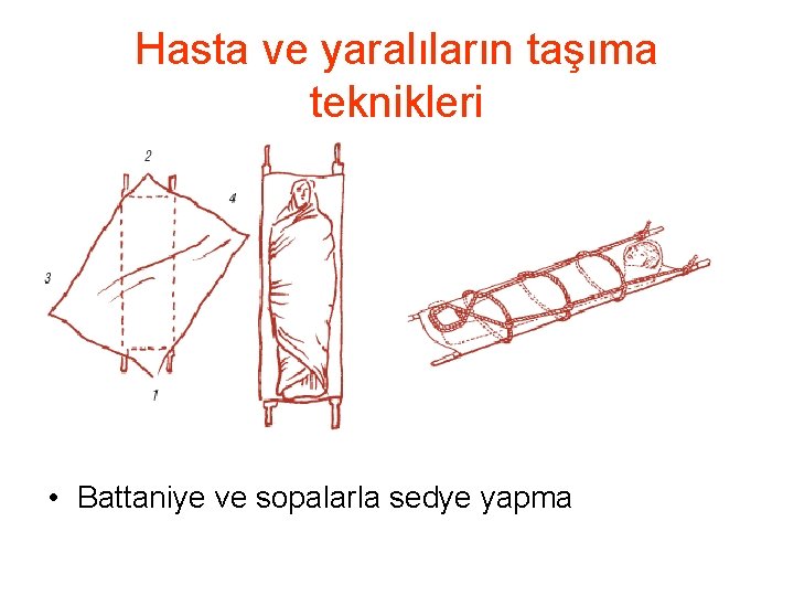 Hasta ve yaralıların taşıma teknikleri • Battaniye ve sopalarla sedye yapma 