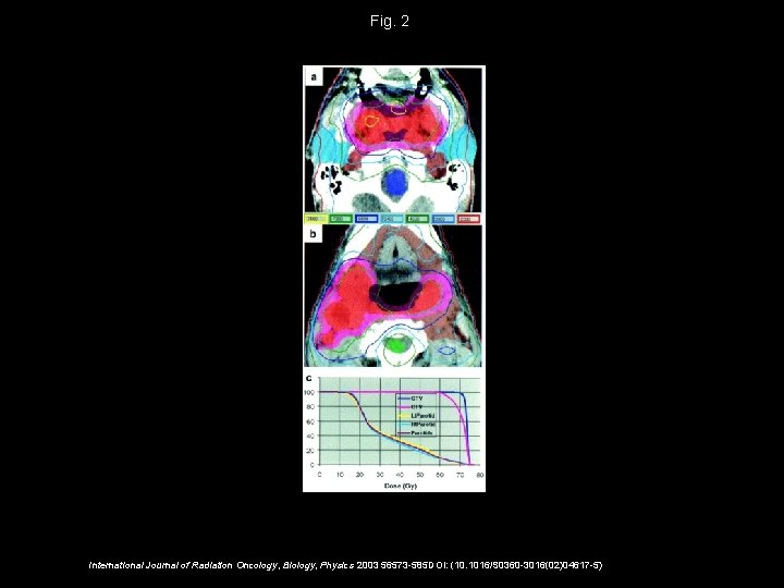 Fig. 2 International Journal of Radiation Oncology, Biology, Physics 2003 56573 -585 DOI: (10.