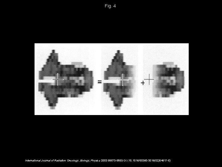 Fig. 4 International Journal of Radiation Oncology, Biology, Physics 2003 56573 -585 DOI: (10.