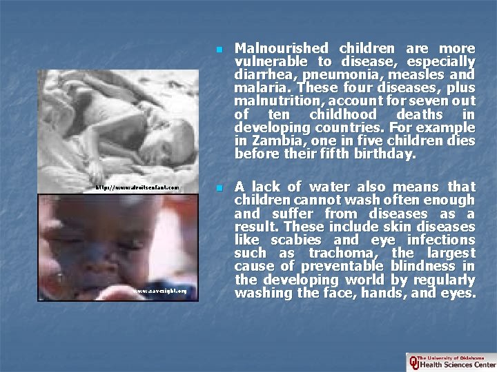 n http: //www. droitsenfant. com www. savesight. org n Malnourished children are more vulnerable