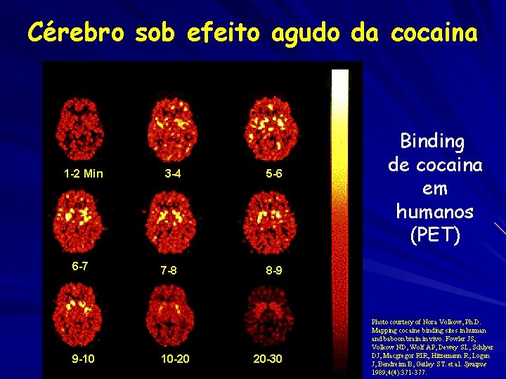 Cérebro sob efeito agudo da cocaina 1 -2 Min 6 -7 9 -10 3