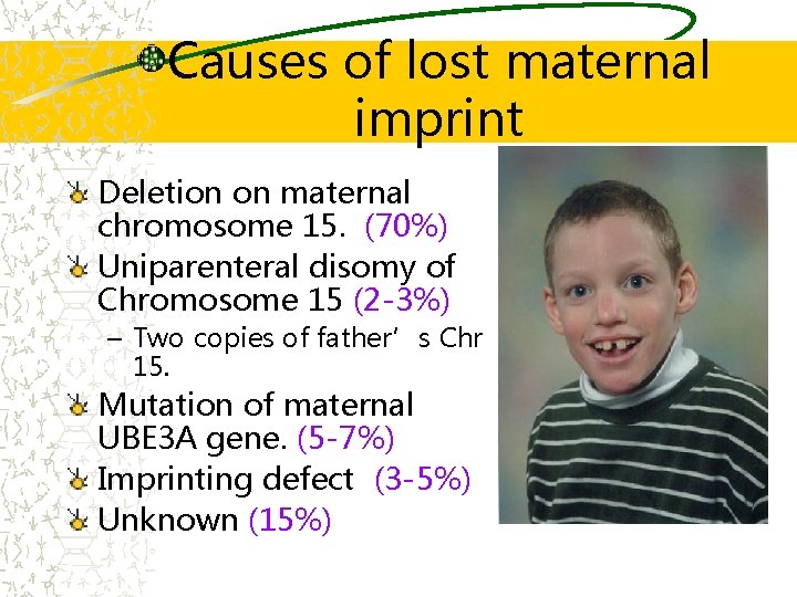Causes of lost maternal imprint Deletion on maternal chromosome 15. (70%) Uniparenteral disomy of