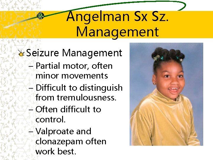 Angelman Sx Sz. Management Seizure Management – Partial motor, often minor movements – Difficult