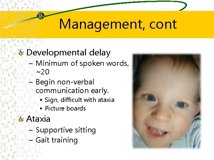 Management, cont Developmental delay – Minimum of spoken words, ~20 – Begin non-verbal communication