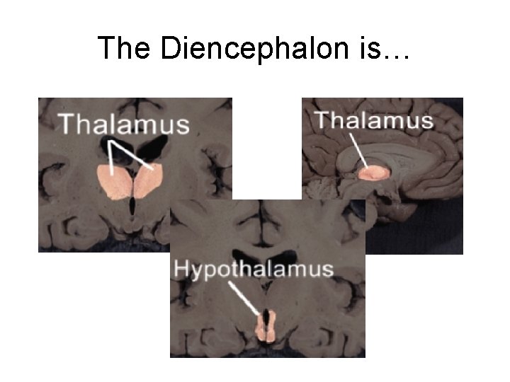 The Diencephalon is… 