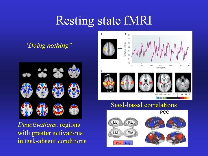 Resting state f. MRI “Doing nothing” Seed-based correlations Deactivations: regions with greater activations in