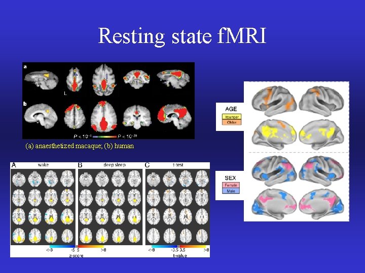 Resting state f. MRI (a) anaesthetized macaque; (b) human 