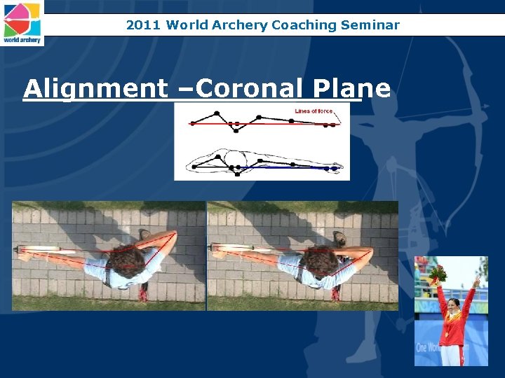 2011 World Archery Coaching Seminar Alignment –Coronal Plane 