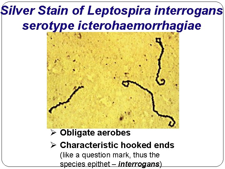 Silver Stain of Leptospira interrogans serotype icterohaemorrhagiae Ø Obligate aerobes Ø Characteristic hooked ends