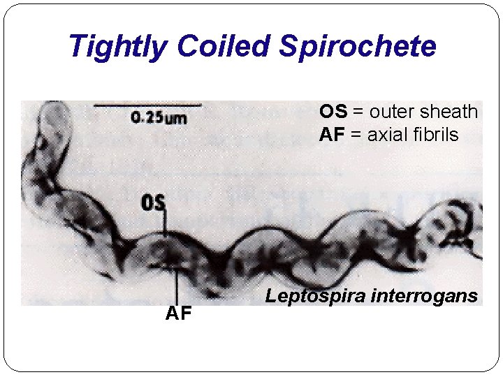 Tightly Coiled Spirochete OS = outer sheath AF = axial fibrils AF Leptospira interrogans