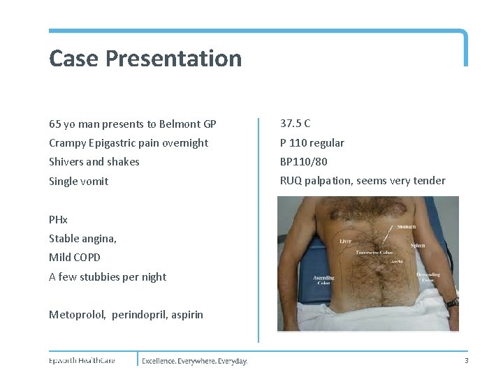 Case Presentation 65 yo man presents to Belmont GP 37. 5 C Crampy Epigastric