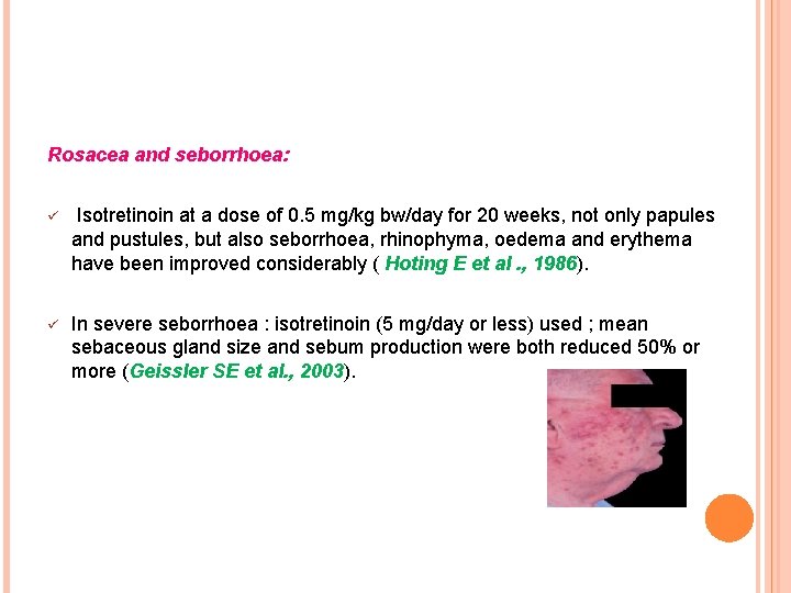 Rosacea and seborrhoea: ü Isotretinoin at a dose of 0. 5 mg/kg bw/day for