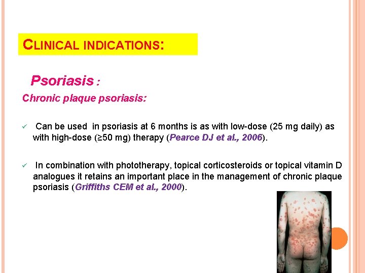 CLINICAL INDICATIONS: Psoriasis : Chronic plaque psoriasis: ü Can be used in psoriasis at