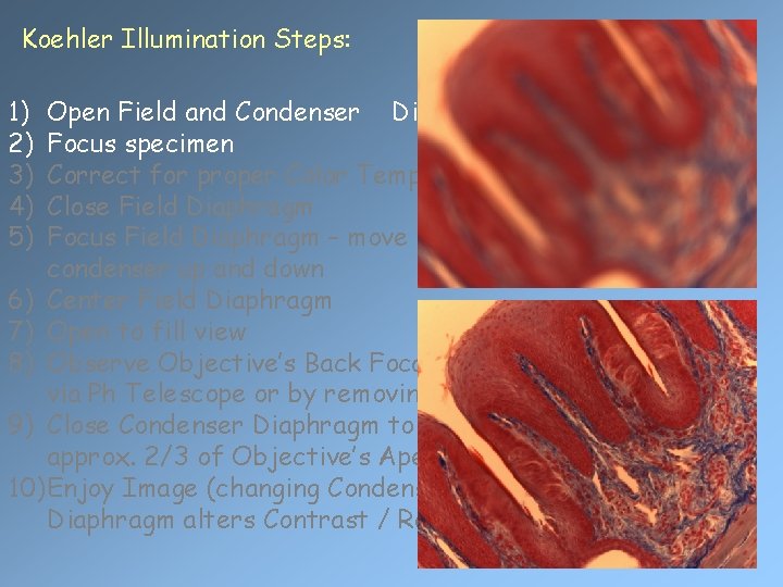 Koehler Illumination Steps: 1) 2) 3) 4) 5) Open Field and Condenser Diaphragms Focus