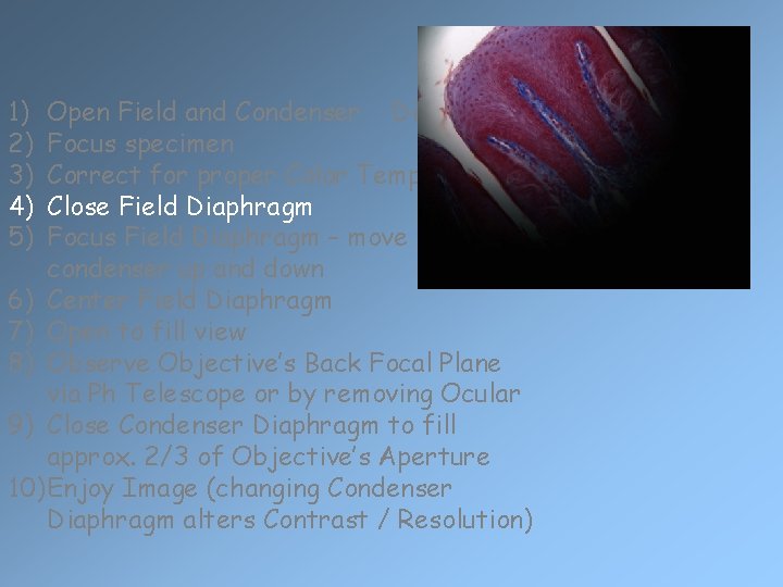 1) 2) 3) 4) 5) Open Field and Condenser Diaphragms Focus specimen Correct for