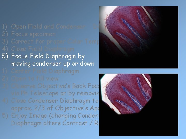 1) 2) 3) 4) 5) Open Field and Condenser Diaphragms Focus specimen Correct for