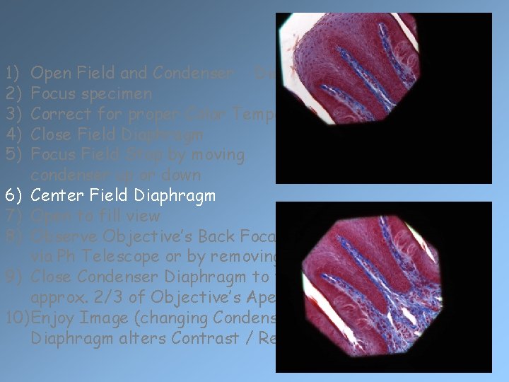 1) 2) 3) 4) 5) Open Field and Condenser Diaphragms Focus specimen Correct for