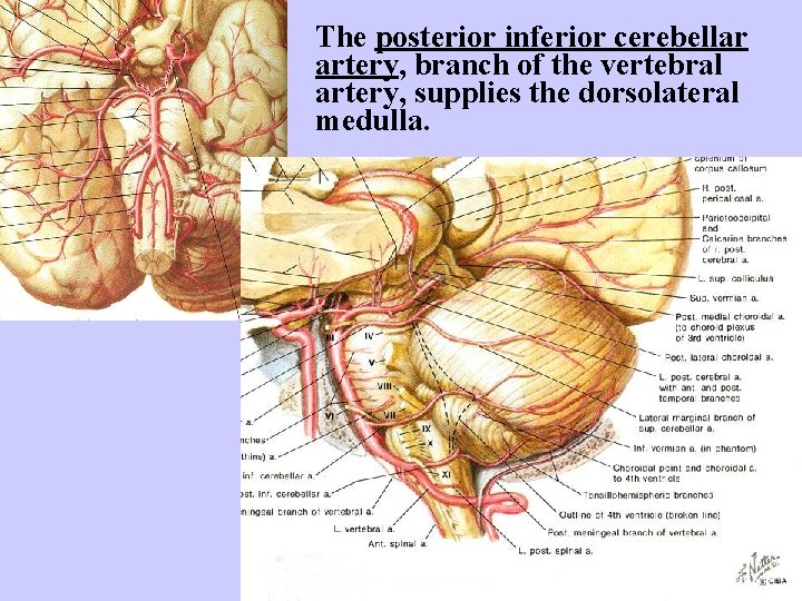 The posterior inferior cerebellar artery, branch of the vertebral artery, supplies the dorsolateral medulla.